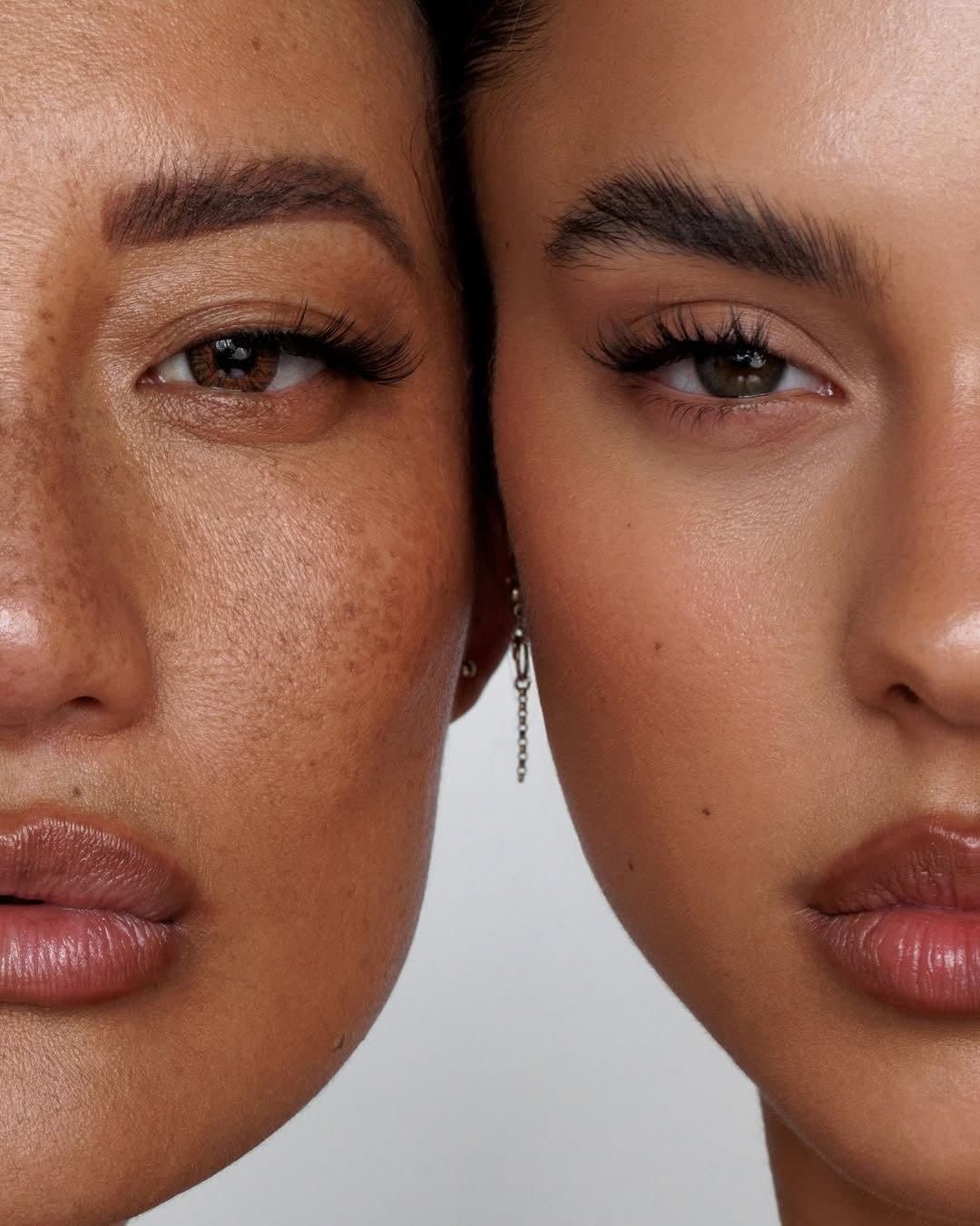 What Is Facial Balancing? Our Approach to Natural, Undetectable Results
