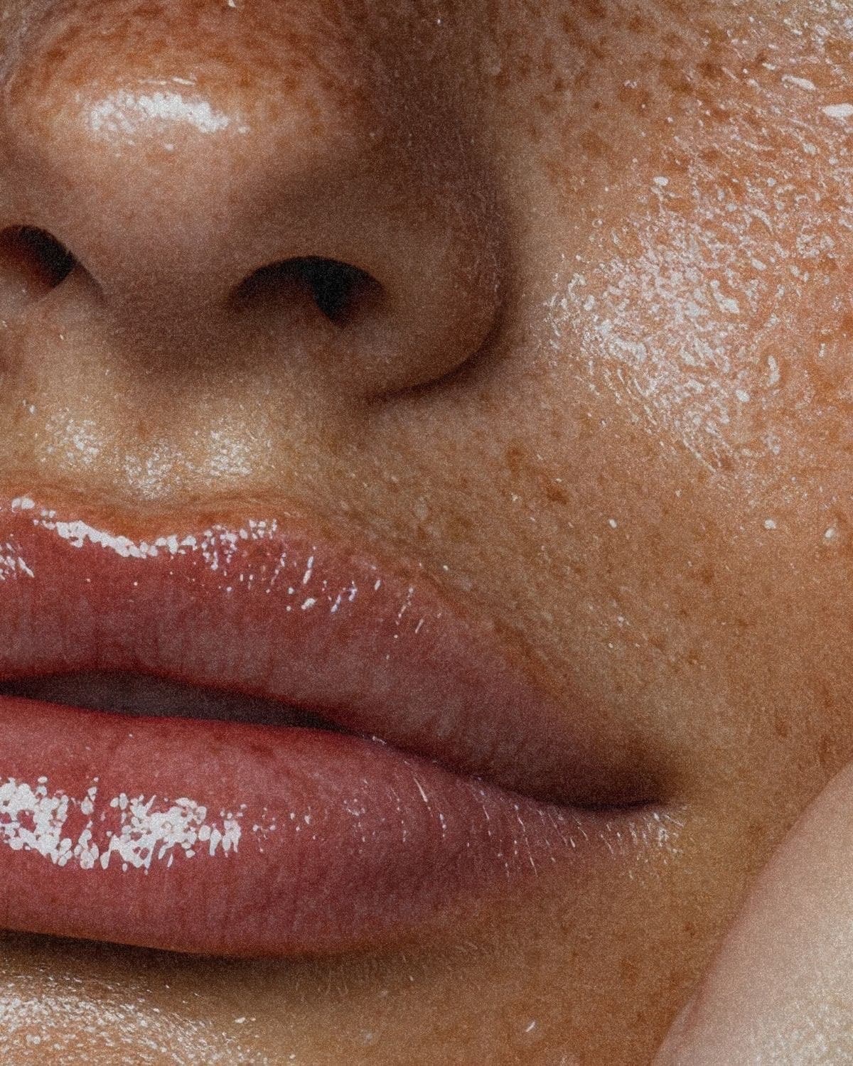 The Lip Fillers We Use in Austin — and How We Choose Between Them