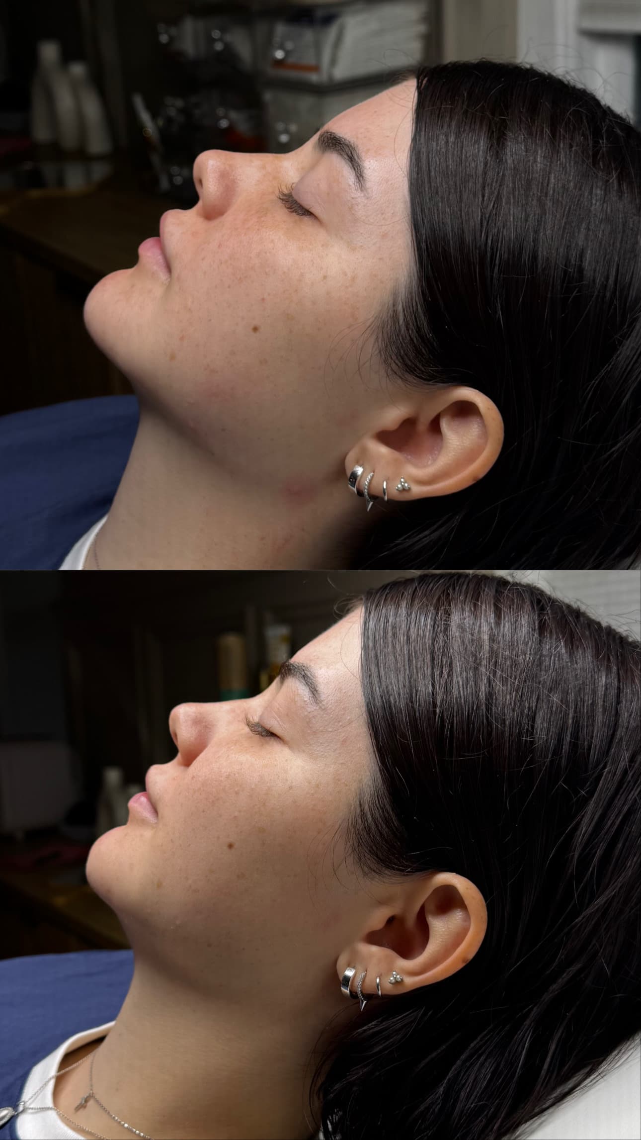 Client before and after treated by Leyla Guzman — result 4