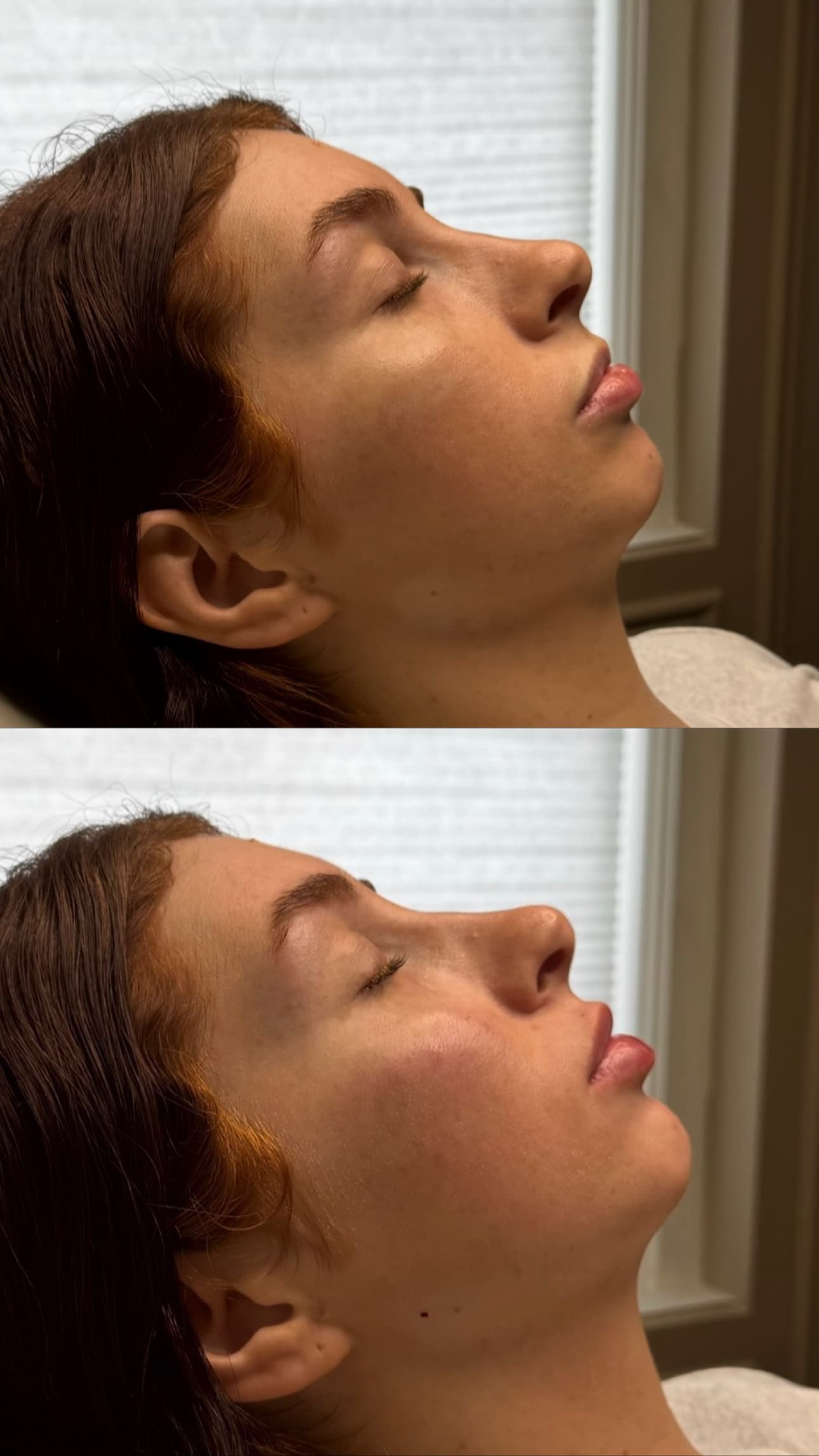 Client before and after treated by Leyla Guzman — result 5