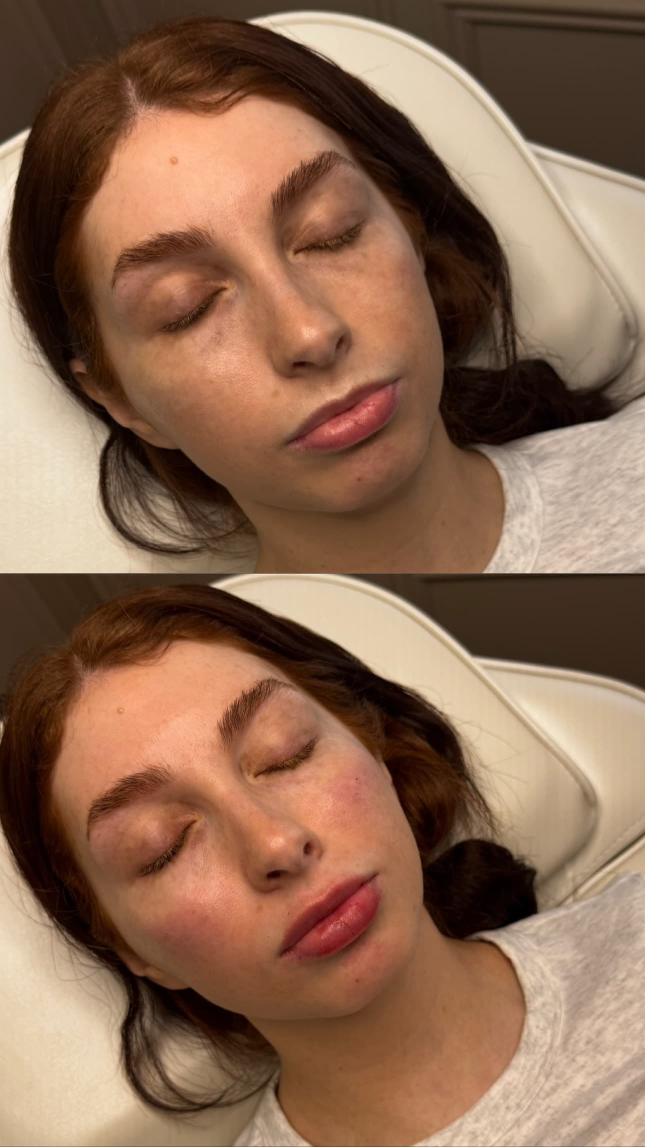 Client before and after treated by Leyla Guzman — result 6