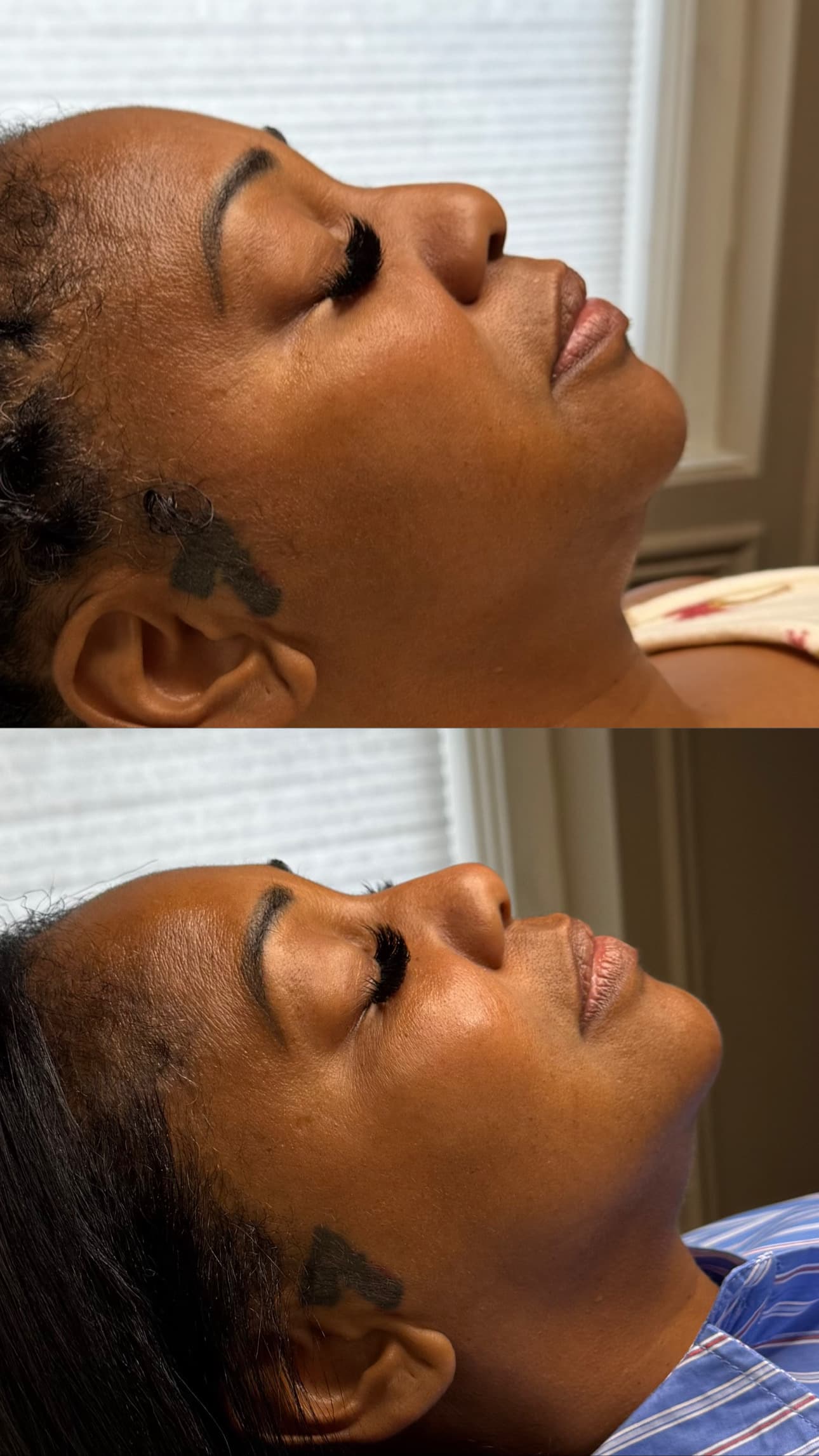 Client before and after treated by Leyla Guzman — result 7