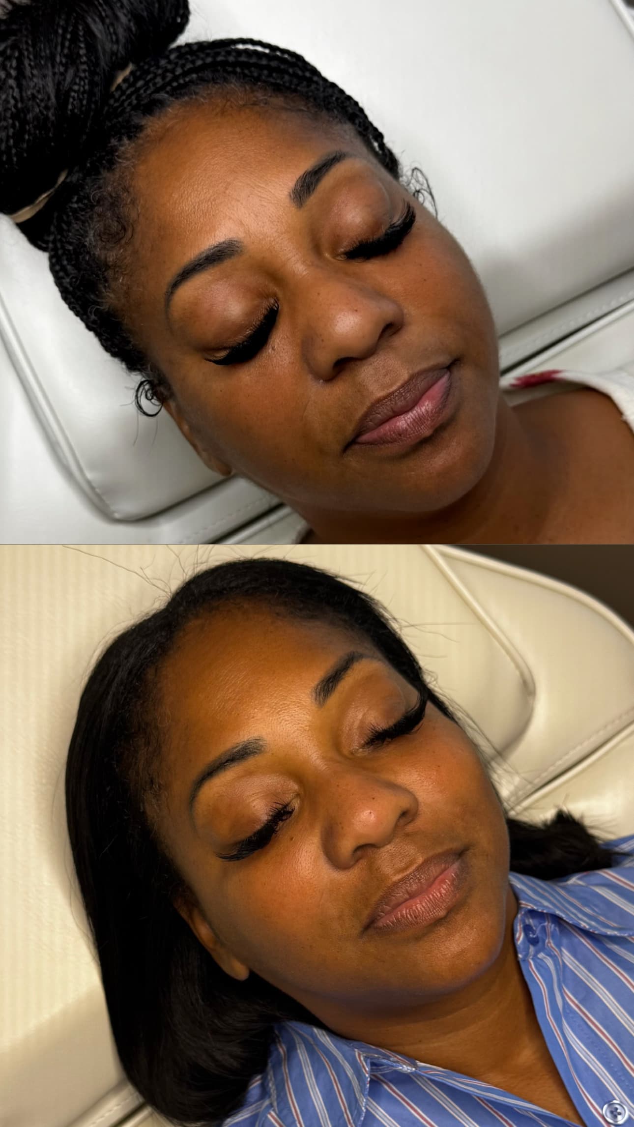 Client before and after treated by Leyla Guzman — result 8